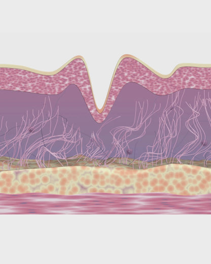 SkinProTech